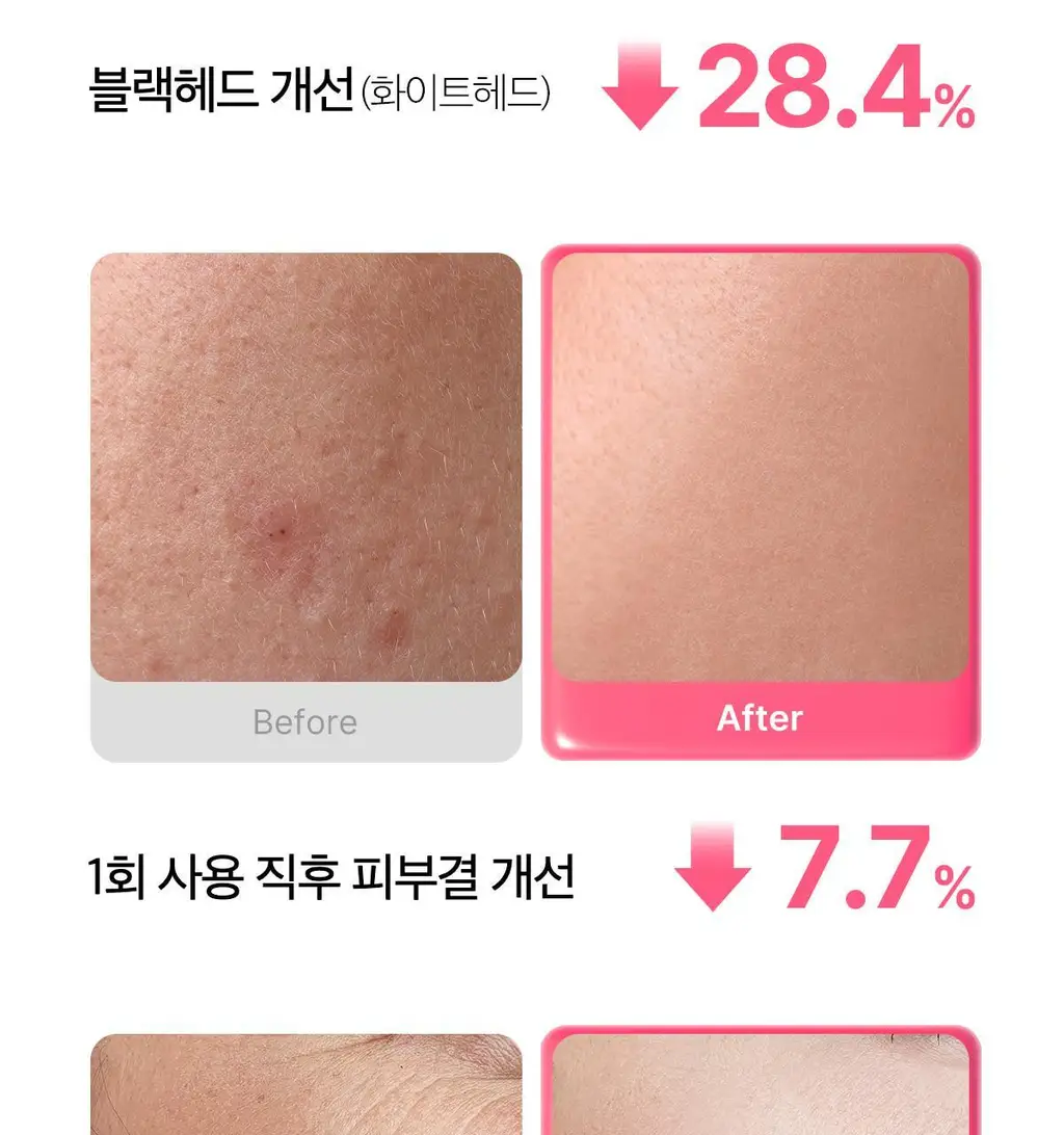 [저자극클렌저] 메디큐브 PDRN 젤투폼 클렌저 200ml 기획(+클렌징브러쉬 증정) 상세페이지 17